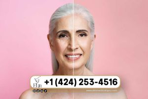 Non-Surgical-Anti-Aging-Treatments-That-Work