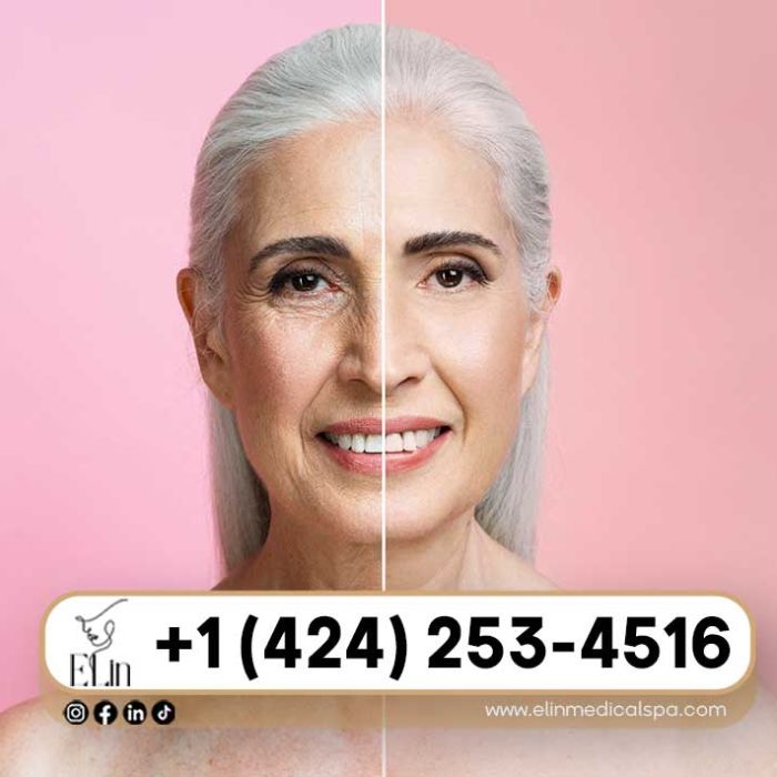 Non-Surgical-Anti-Aging-Treatments-That-Work