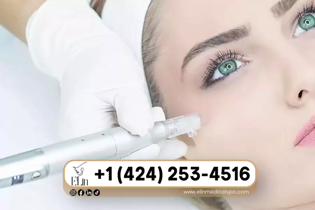 Best Microneedling in Beverly Hills
