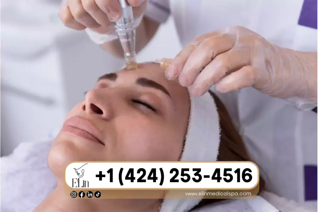  Best Serums to Use After Microneedling