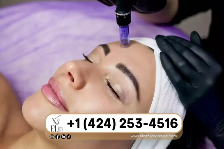 Microneedling in Beverly Hills: Solutions for Scars & Spots