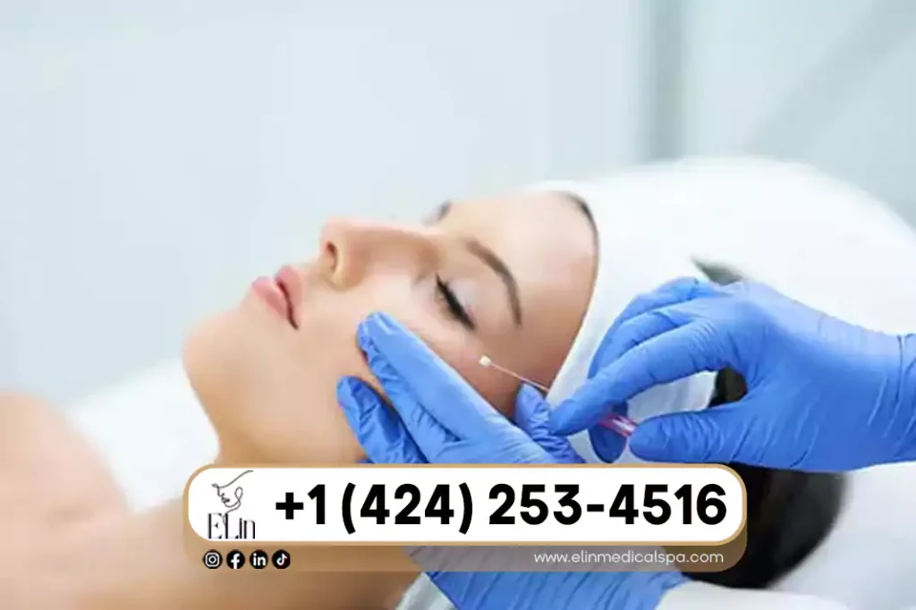 Can PDO Threads Replace Fillers Completely
