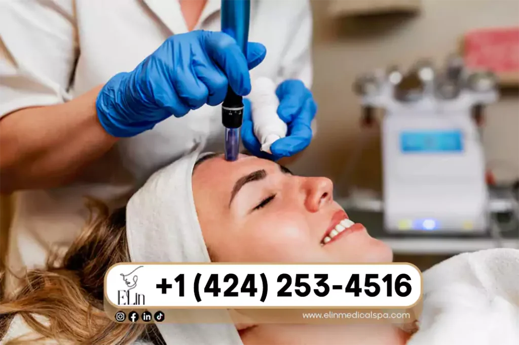 Microneedling Cost in Beverly Hills