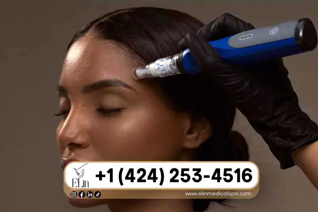 Microneedling Results Timeline