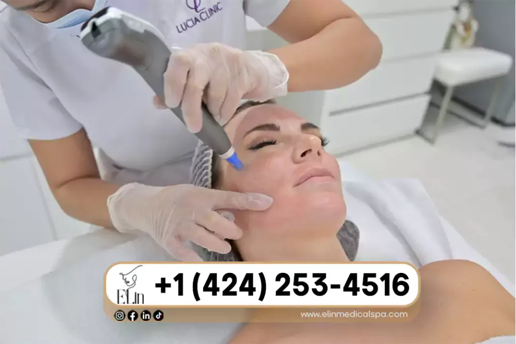 Microneedling for Wrinkles