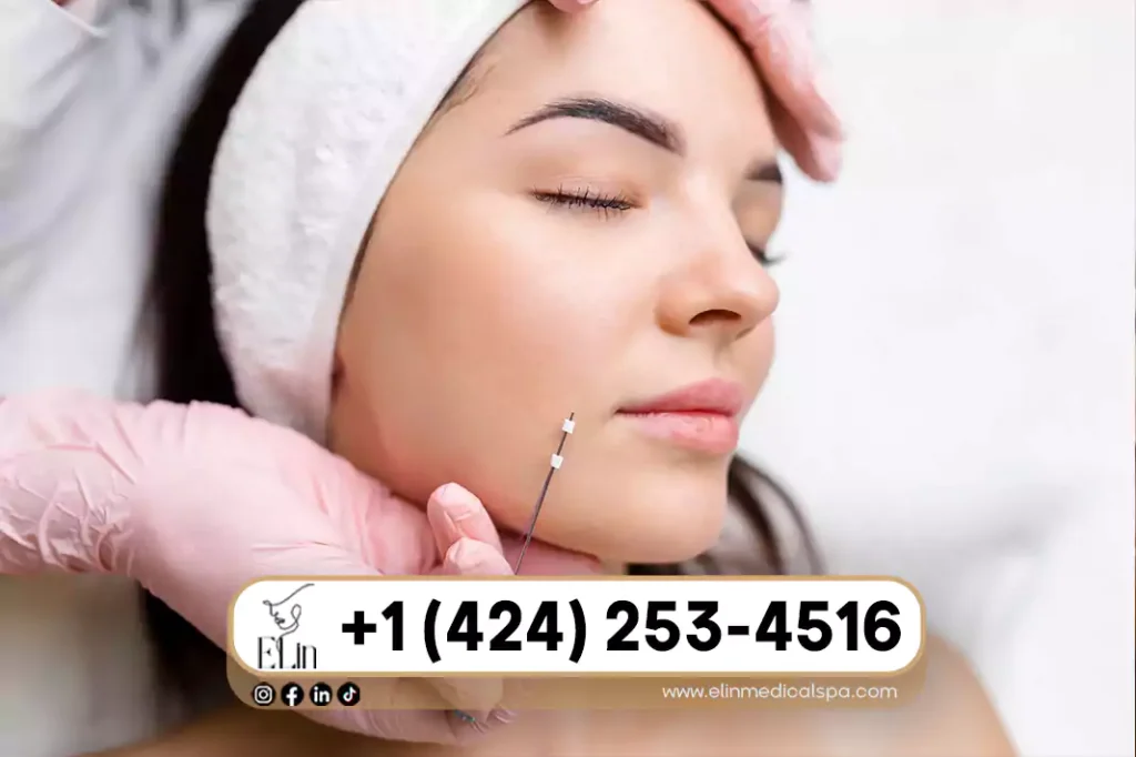 PDO Thread Lift Recovery and Aftercare
