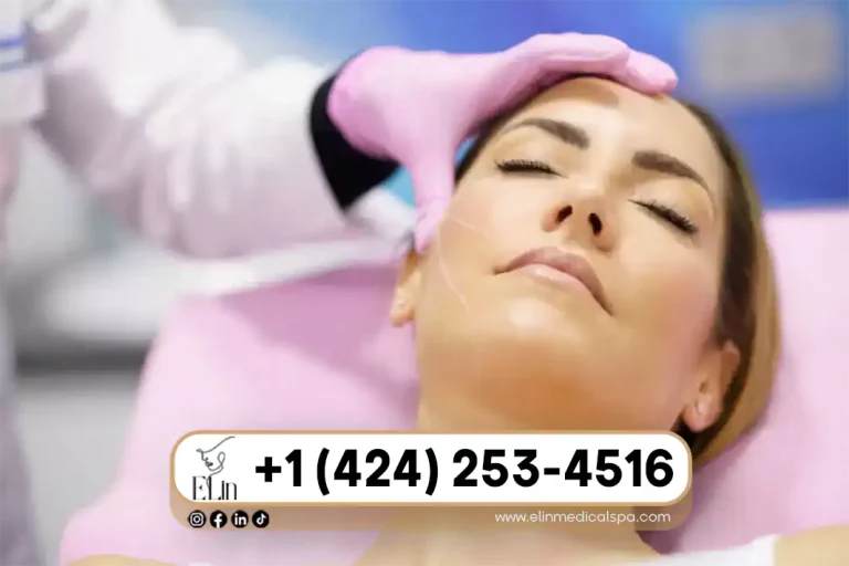 PDO Threads for Nasolabial Folds: Does It Work?