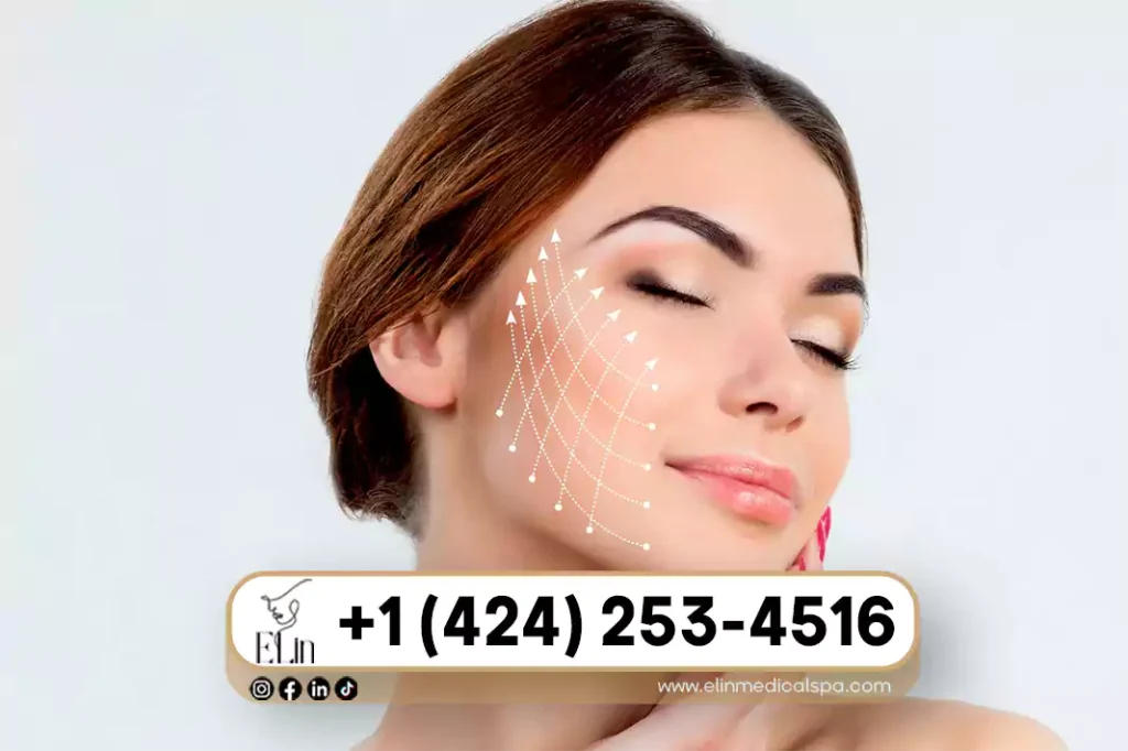 PDO Threads vs Facelift: Pros & Cons