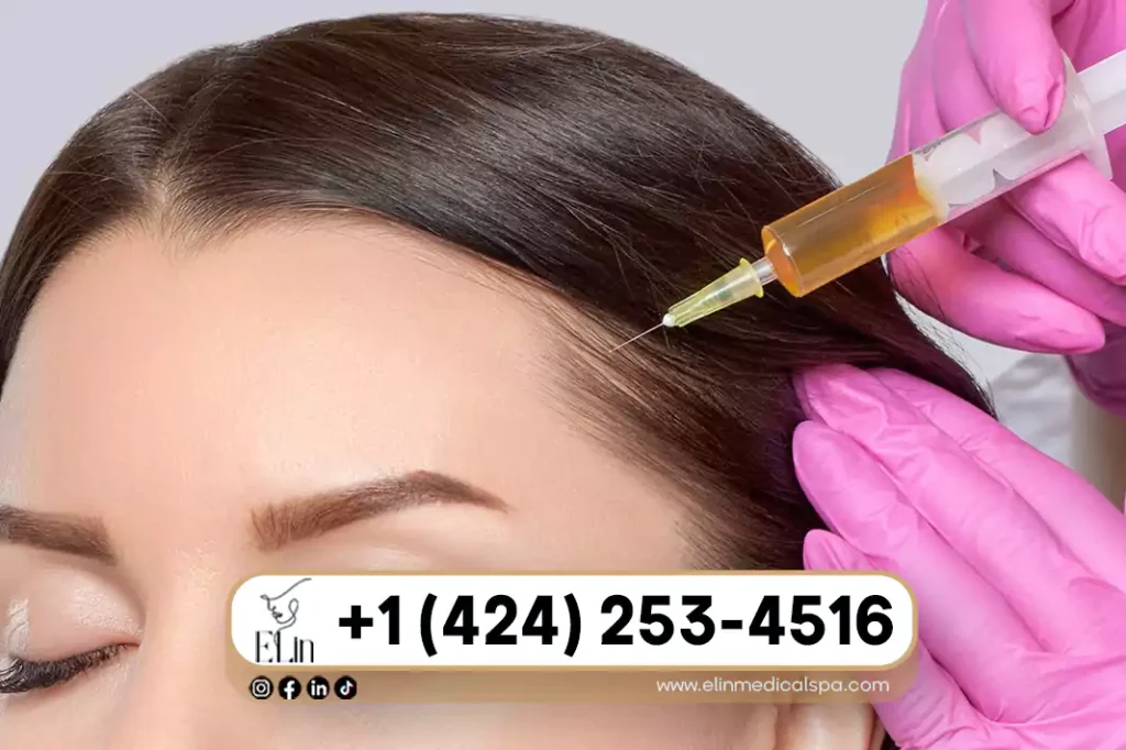 PRP for Hair Loss