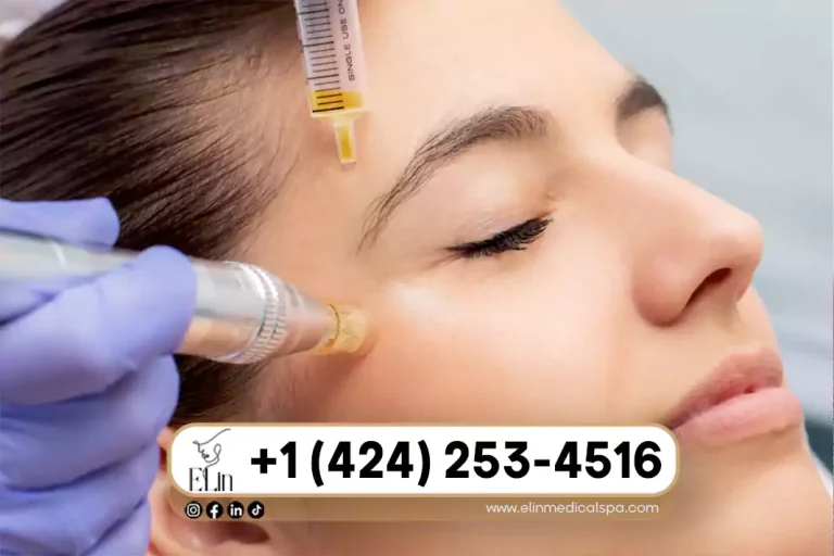 PRP for Skin Rejuvenation: Full Face Guide