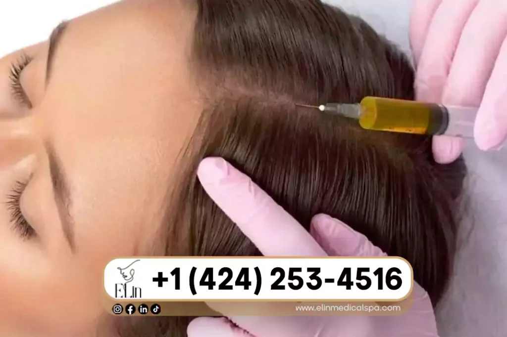 PRP vs Microneedling Which Is Better