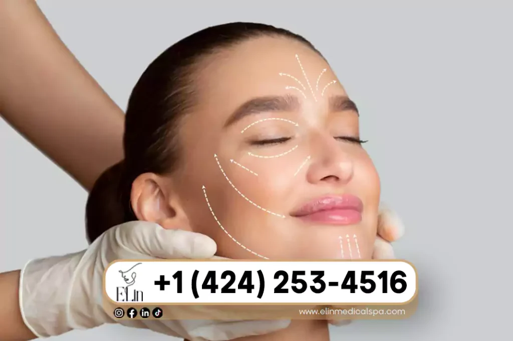 Sculptra Before and After