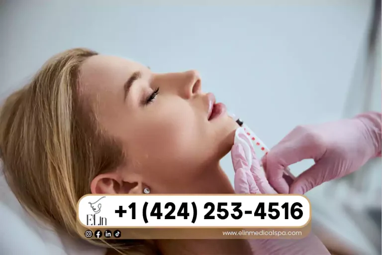 Sculptra Cost in Beverly Hills