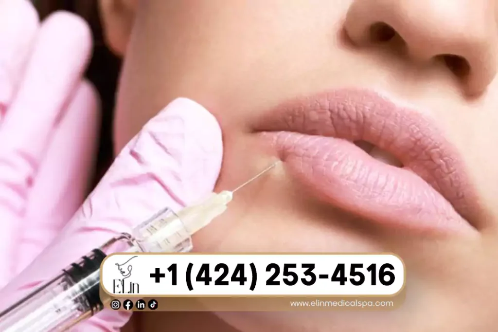 Can Fillers Go Wrong