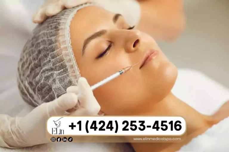 How Often Should You Get Fillers?